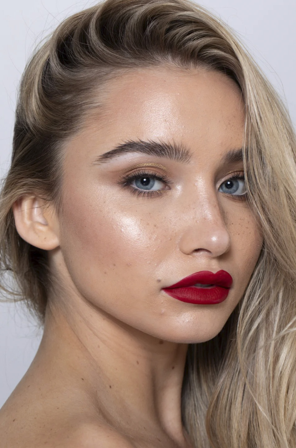 密集雀斑修复前后对比